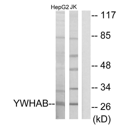 Western Blot - Anti-14-3-3 beta Antibody (C12001) - Antibodies.com