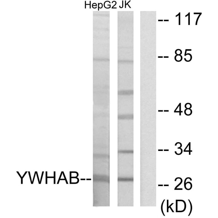 Western Blot - Anti-14-3-3 beta Antibody (C12001) - Antibodies.com