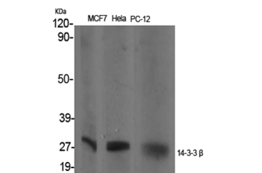 Western Blot - Anti-14-3-3 beta Antibody (C12001) - Antibodies.com