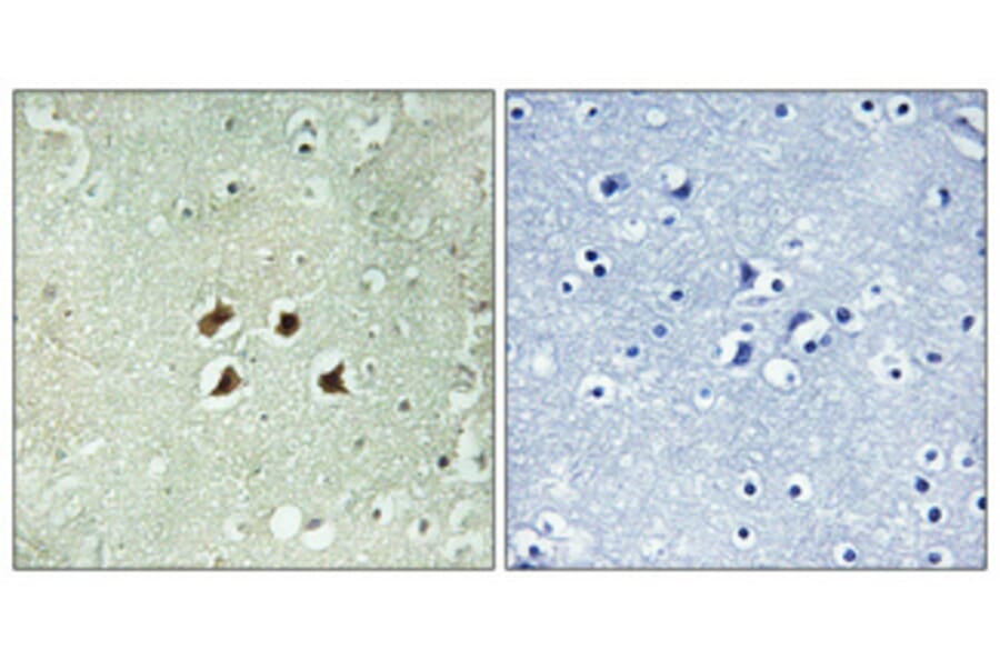 Immunohistochemistry - Anti-Huntingtin Antibody (B1050) - Antibodies.com