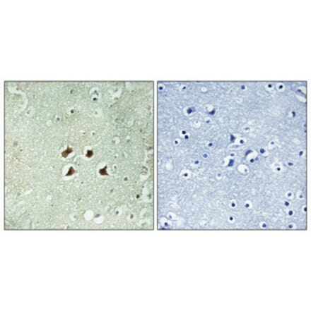 Immunohistochemistry - Anti-Huntingtin Antibody (B1050) - Antibodies.com