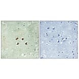Immunohistochemistry - Anti-Huntingtin Antibody (B1050) - Antibodies.com