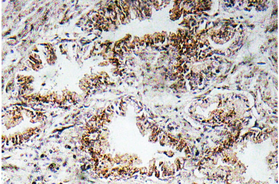 Immunohistochemistry - Anti-AChRalpha1 Antibody (R12-2007) - Antibodies.com