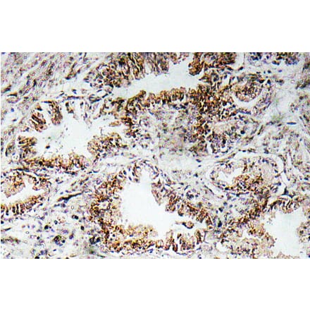 Immunohistochemistry - Anti-AChRalpha1 Antibody (R12-2007) - Antibodies.com