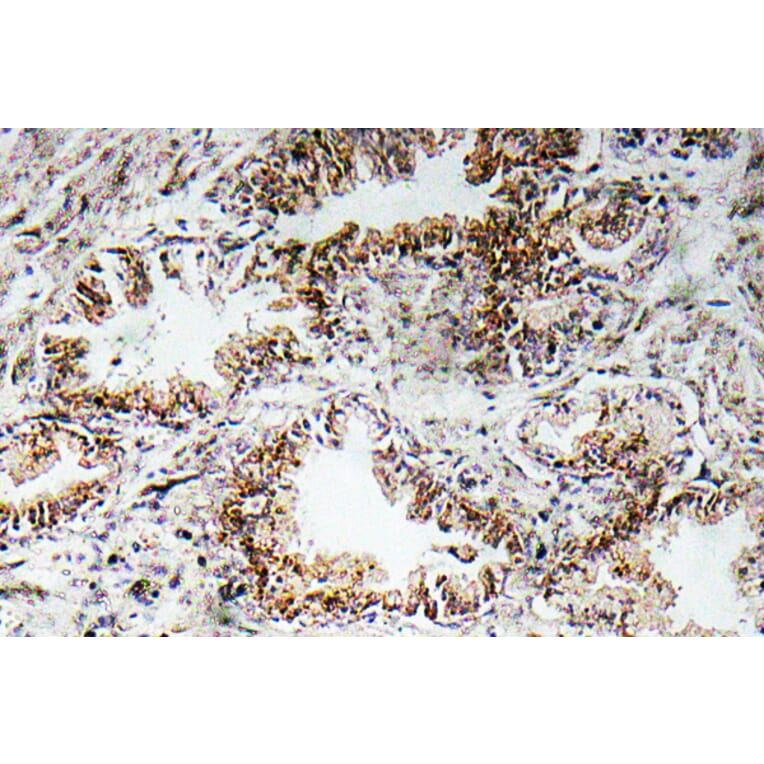 Immunohistochemistry - Anti-AChRalpha1 Antibody (R12-2007) - Antibodies.com