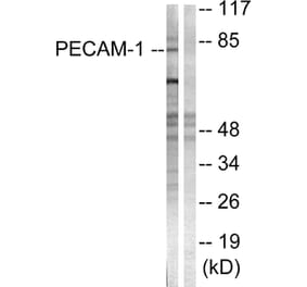 Western Blot - Anti-PECAM-1 Antibody (B0547) - Antibodies.com