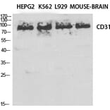 Western Blot - Anti-PECAM-1 Antibody (B0547) - Antibodies.com