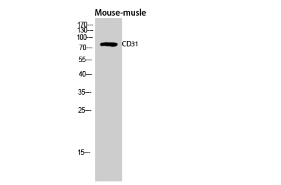 Western Blot - Anti-PECAM-1 Antibody (B0547) - Antibodies.com