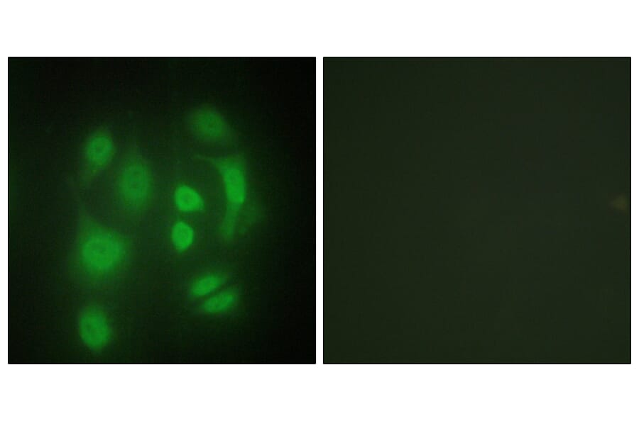 Immunofluorescence - Anti-hnRNP Q Antibody (C10139) - Antibodies.com