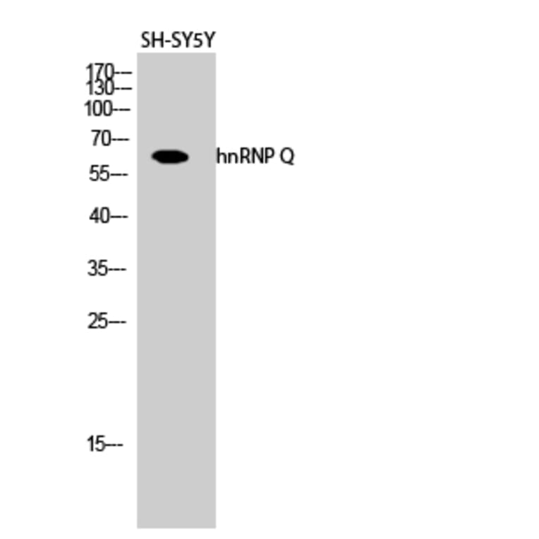 Western Blot - Anti-hnRNP Q Antibody (C10139) - Antibodies.com
