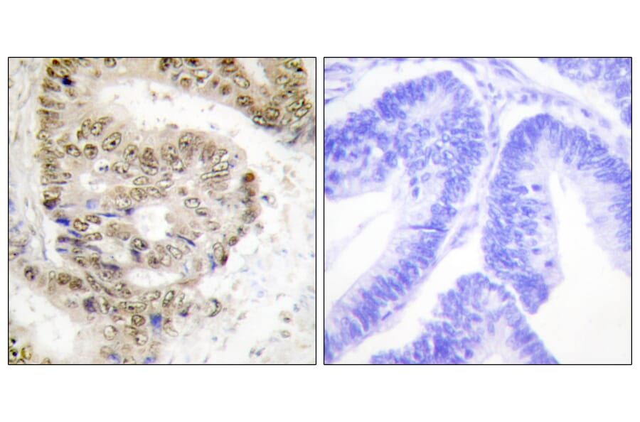 Immunohistochemistry - Anti-hnRNP L Antibody (C10375) - Antibodies.com