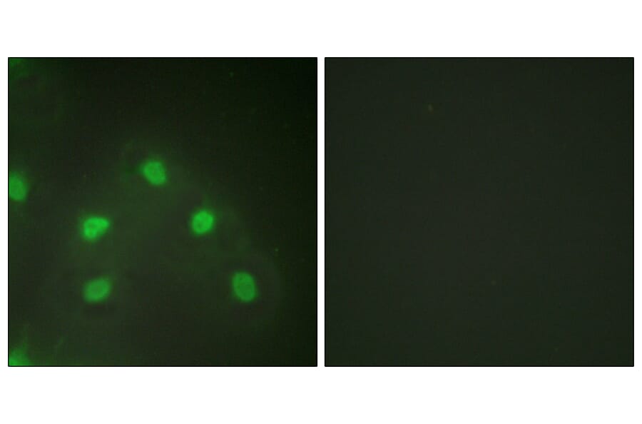 Immunofluorescence - Anti-hnRNP L Antibody (C10375) - Antibodies.com