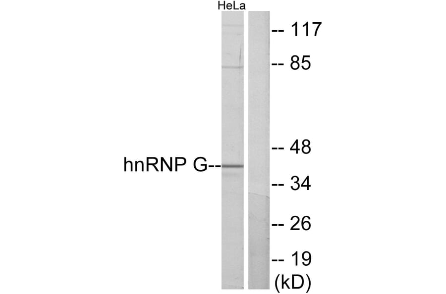 Western Blot - Anti-hnRNP G Antibody (C10581) - Antibodies.com