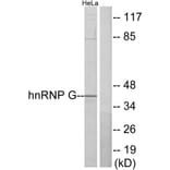 Western Blot - Anti-hnRNP G Antibody (C10581) - Antibodies.com