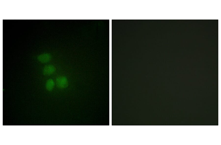 Immunofluorescence - Anti-hnRNP G Antibody (C10581) - Antibodies.com