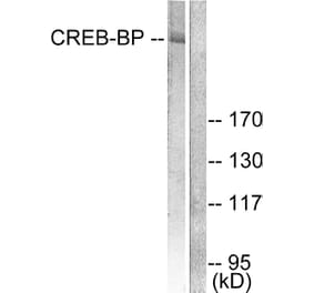 Western Blot - Anti-CREB-BP Antibody (C0161) - Antibodies.com