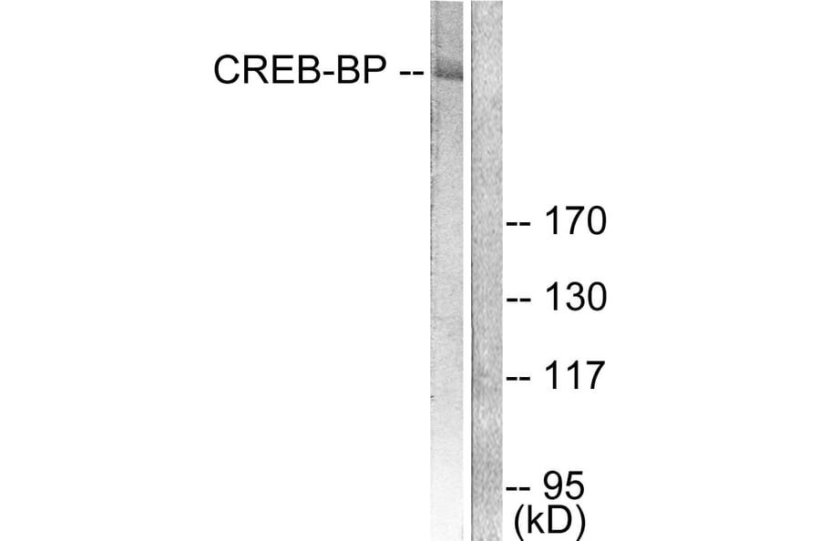 Western Blot - Anti-CREB-BP Antibody (C0161) - Antibodies.com