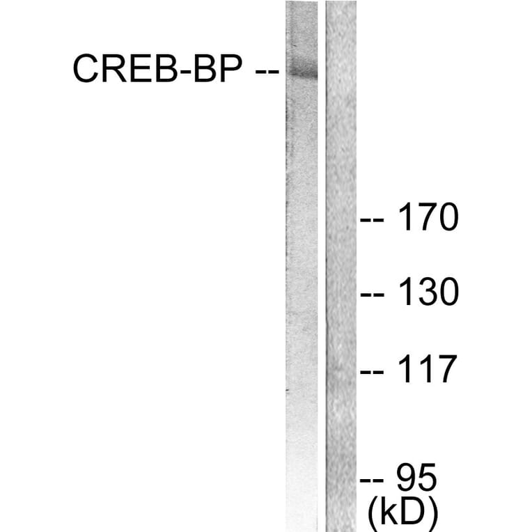 Western Blot - Anti-CREB-BP Antibody (C0161) - Antibodies.com