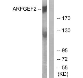 Western Blot - Anti-ARFGEF2 Antibody (C14804) - Antibodies.com