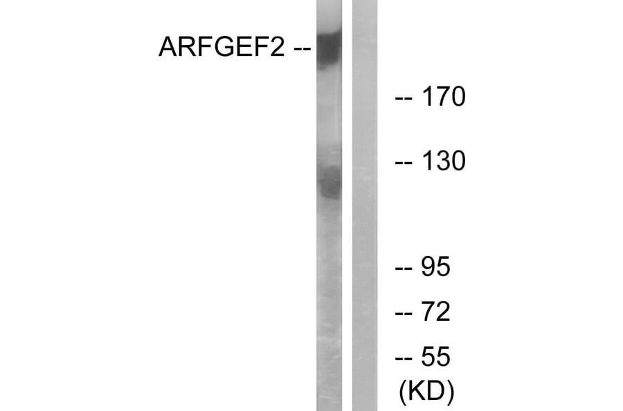 Western Blot - Anti-ARFGEF2 Antibody (C14804) - Antibodies.com