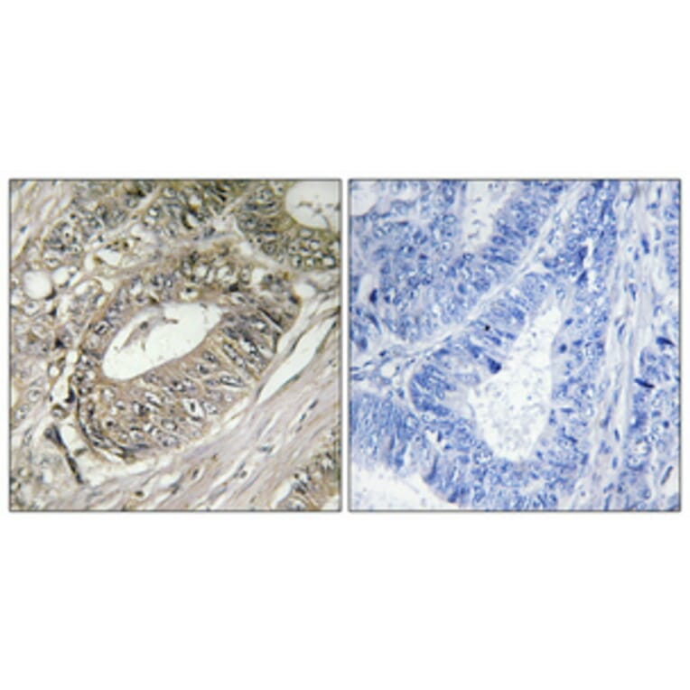 Immunohistochemistry - Anti-ARFGEF2 Antibody (C14804) - Antibodies.com