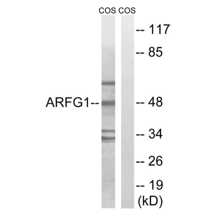 Western Blot - Anti-ARFGAP1 Antibody (C14345) - Antibodies.com