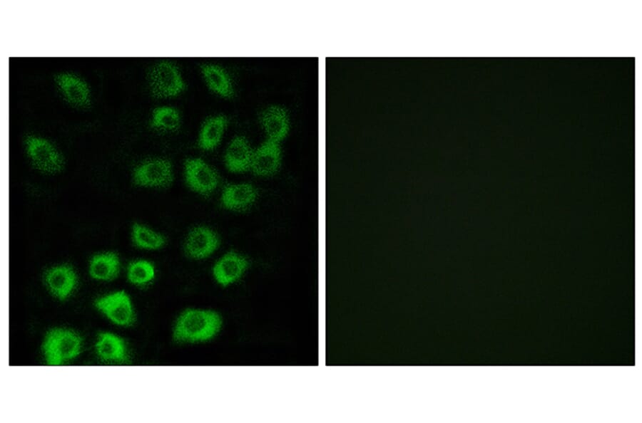 Immunofluorescence - Anti-ARFGAP1 Antibody (C14345) - Antibodies.com