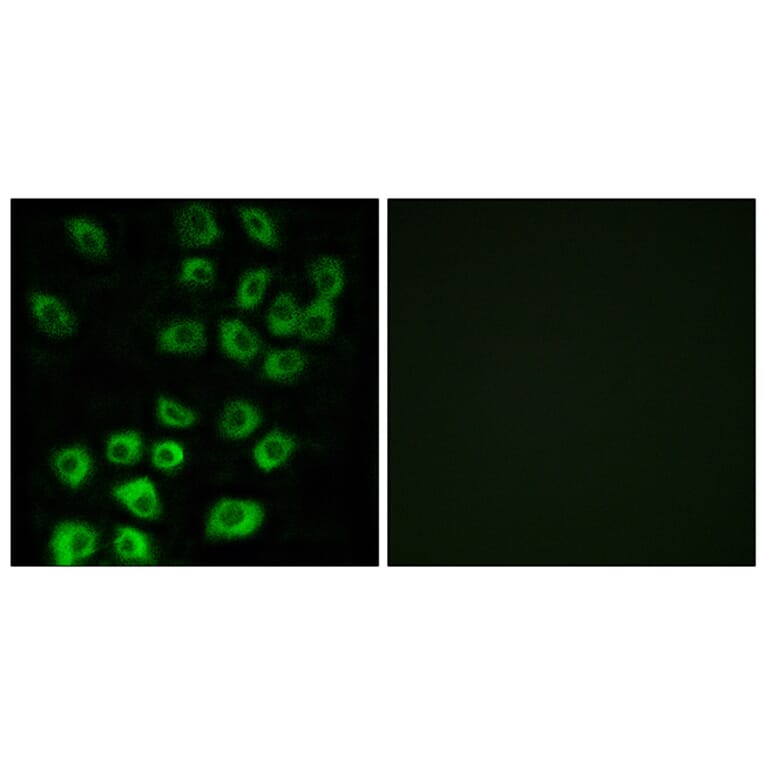 Immunofluorescence - Anti-ARFGAP1 Antibody (C14345) - Antibodies.com