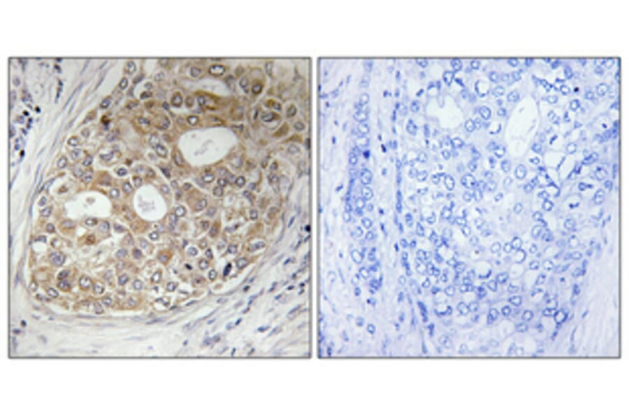 Immunohistochemistry - Anti-ARFGAP1 Antibody (C14345) - Antibodies.com