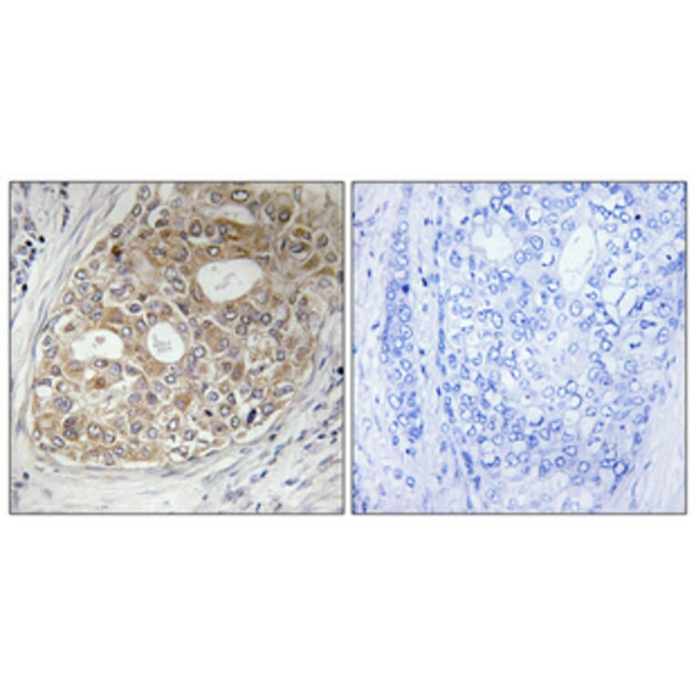 Immunohistochemistry - Anti-ARFGAP1 Antibody (C14345) - Antibodies.com