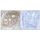 Immunohistochemistry - Anti-ARFGAP1 Antibody (C14345) - Antibodies.com