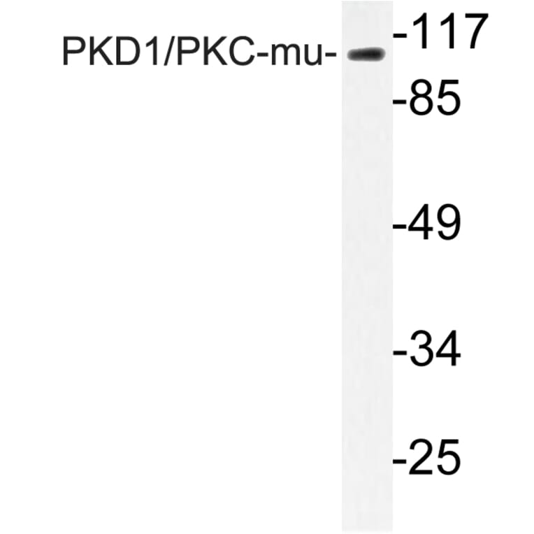 Western Blot - Anti-PKC mu Antibody (R12-2310) - Antibodies.com