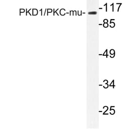 Western Blot - Anti-PKC mu Antibody (R12-2311) - Antibodies.com