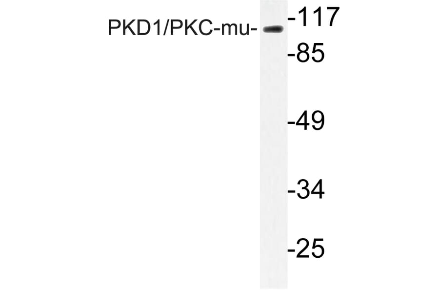 Western Blot - Anti-PKC mu Antibody (R12-2311) - Antibodies.com