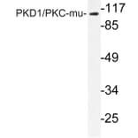 Western Blot - Anti-PKC mu Antibody (R12-2311) - Antibodies.com