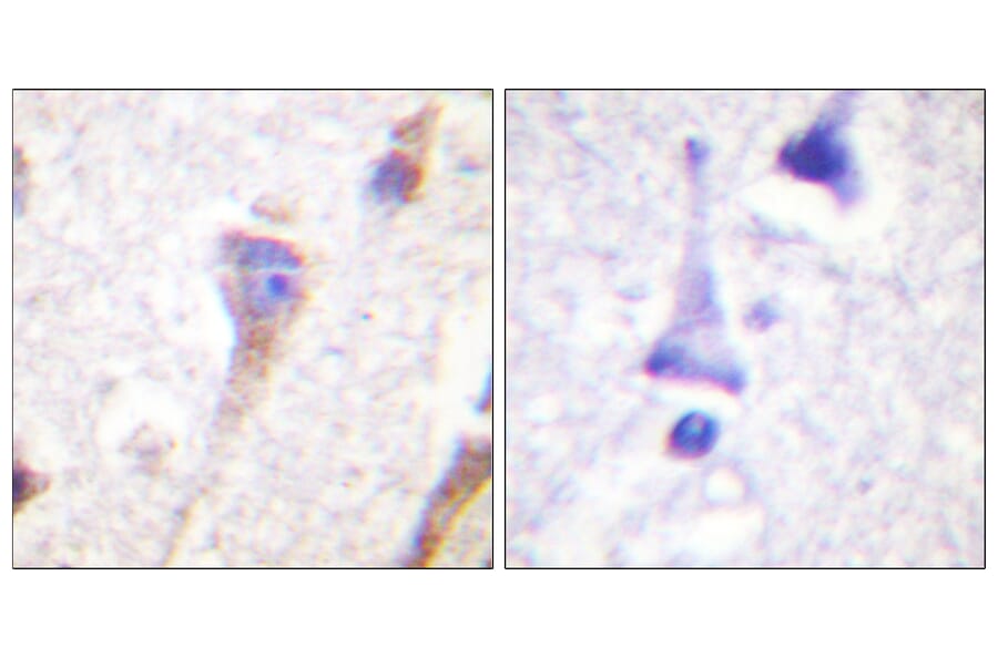 Immunohistochemistry - Anti-PKC mu Antibody (B0807) - Antibodies.com