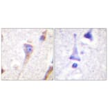 Immunohistochemistry - Anti-PKC mu Antibody (B0807) - Antibodies.com