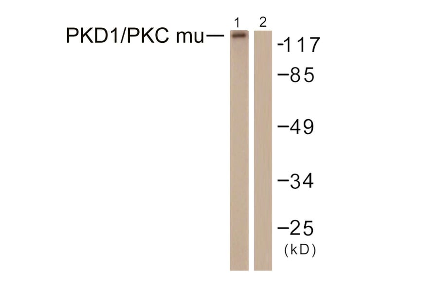 Western Blot - Anti-PKC mu Antibody (B0807) - Antibodies.com