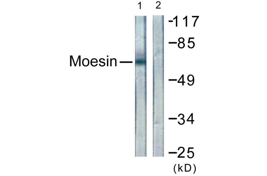 Western Blot - Anti-Moesin Antibody (B1102) - Antibodies.com