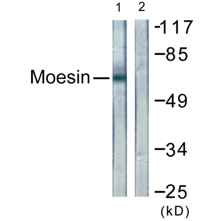 Western Blot - Anti-Moesin Antibody (B1102) - Antibodies.com