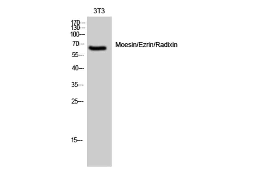 Western Blot - Anti-Moesin Antibody (B1102) - Antibodies.com