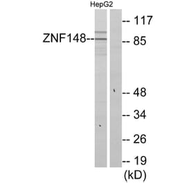 Western Blot - Anti-ZNF148 Antibody (C11914) - Antibodies.com