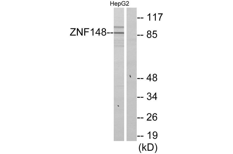 Western Blot - Anti-ZNF148 Antibody (C11914) - Antibodies.com