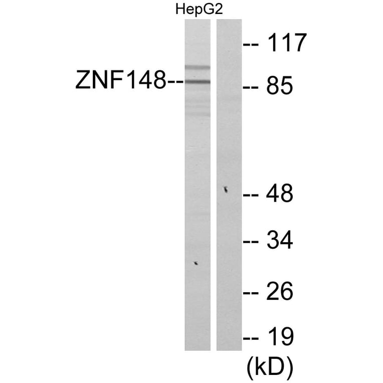 Western Blot - Anti-ZNF148 Antibody (C11914) - Antibodies.com