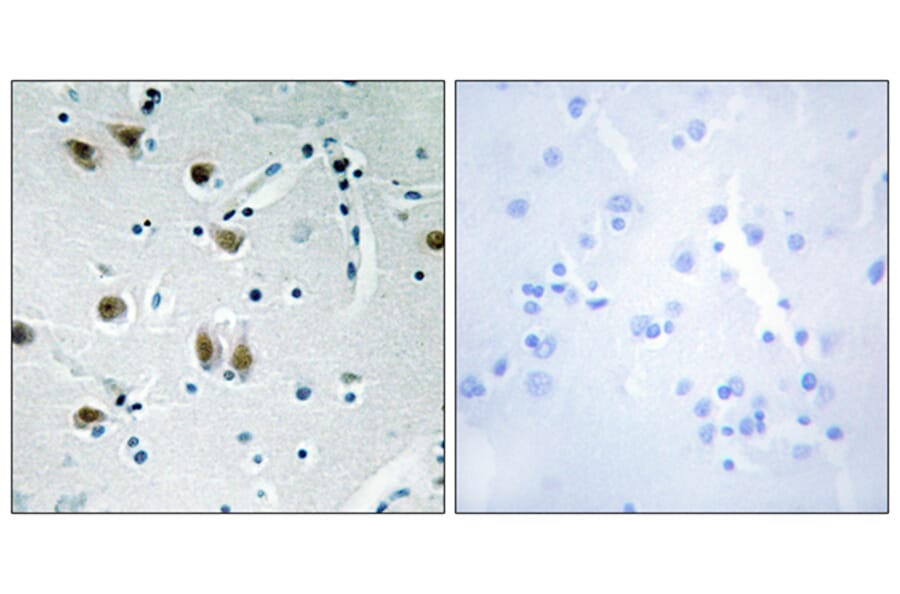 Immunohistochemistry - Anti-ZNF148 Antibody (C11914) - Antibodies.com