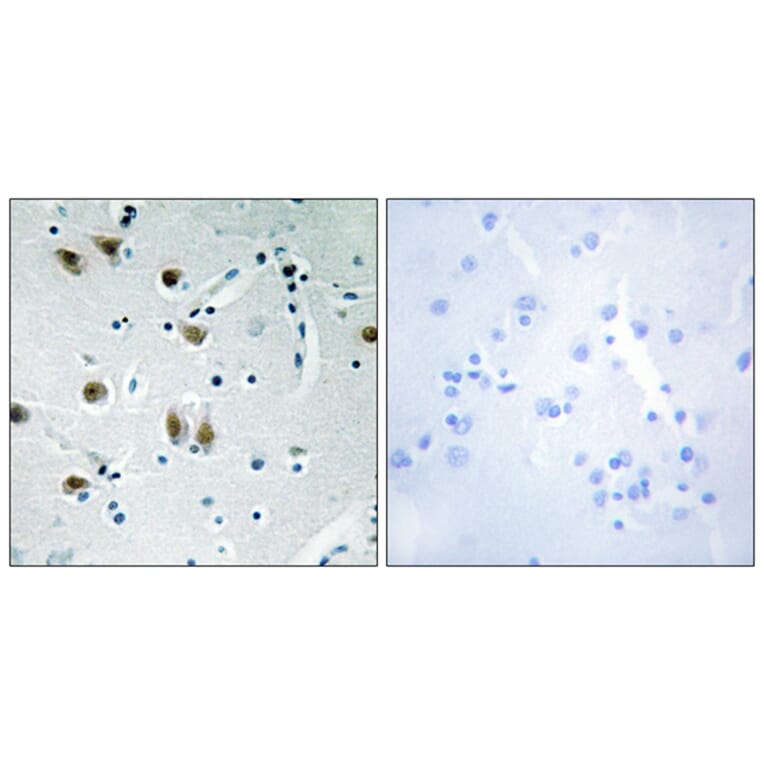 Immunohistochemistry - Anti-ZNF148 Antibody (C11914) - Antibodies.com
