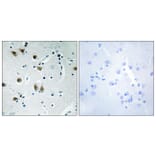 Immunohistochemistry - Anti-ZNF148 Antibody (C11914) - Antibodies.com