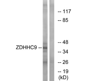 Western Blot - Anti-ZDHHC9 Antibody (C17600) - Antibodies.com