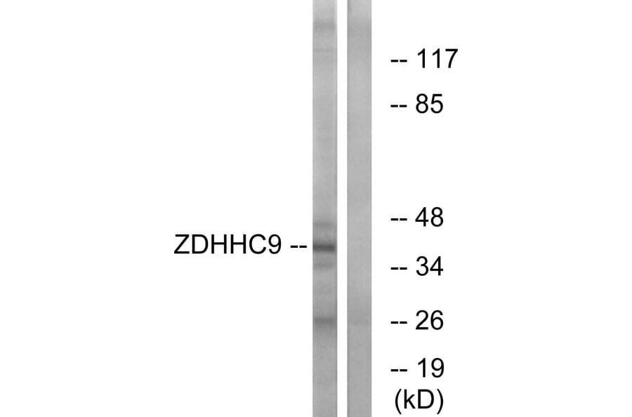 Western Blot - Anti-ZDHHC9 Antibody (C17600) - Antibodies.com