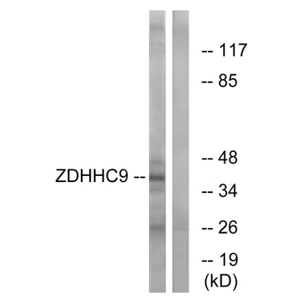Western Blot - Anti-ZDHHC9 Antibody (C17600) - Antibodies.com
